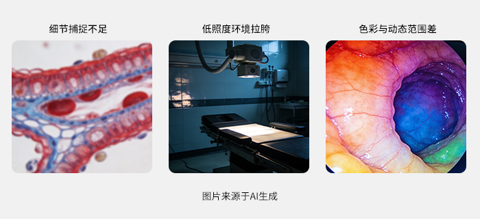 电子阴道镜成像的三大核心难题